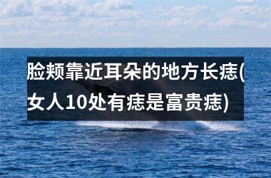 脸颊靠近耳朵的地方长痣(女人10处有痣是富贵痣)