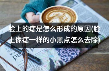 脸上的痣是怎么形成的原因(脸上像痣一样的小黑点怎么去除)