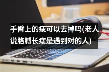 <h3>手臂上的痣可以去掉吗(老人说胳膊长痣是遇到对的人)