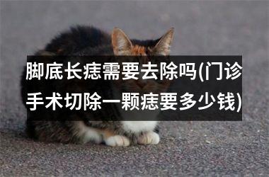 脚底长痣需要去除吗(门诊手术切除一颗痣要多少钱)