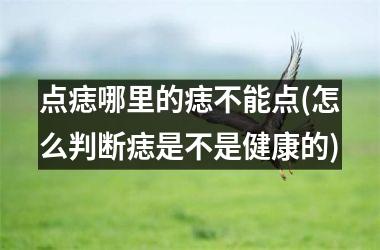 点痣哪里的痣不能点(怎么判断痣是不是健康的)