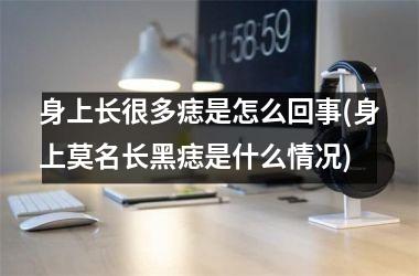 身上长很多痣是怎么回事(身上莫名长黑痣是什么情况)