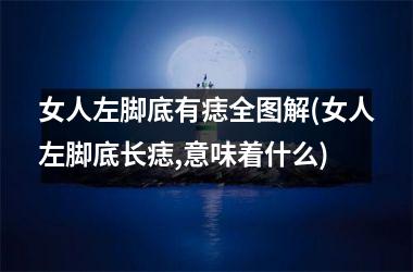 女人左脚底有痣全图解(女人左脚底长痣,意味着什么)