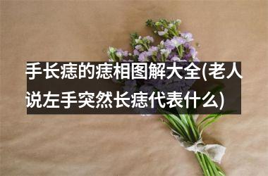 手长痣的痣相图解大全(老人说左手突然长痣代表什么)