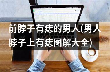 <h3>前脖子有痣的男人(男人脖子上有痣图解大全)