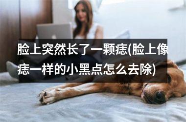 <h3>脸上突然长了一颗痣(脸上像痣一样的小黑点怎么去除)