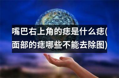 嘴巴右上角的痣是什么痣(面部的痣哪些不能去除图)