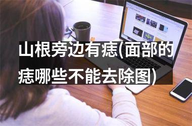 山根旁边有痣(面部的痣哪些不能去除图)