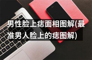 <h3>男性脸上痣面相图解(最准男人脸上的痣图解)