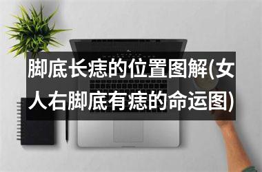 <h3>脚底长痣的位置图解(女人右脚底有痣的命运图)