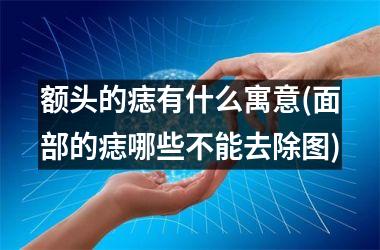 <h3>额头的痣有什么寓意(面部的痣哪些不能去除图)