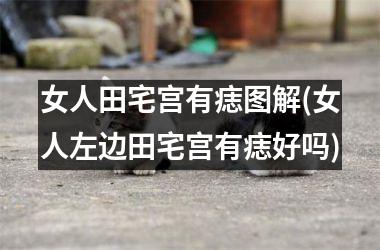 女人田宅宫有痣图解(女人左边田宅宫有痣好吗)