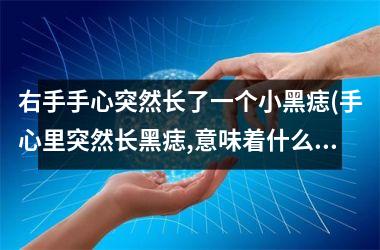 右手手心突然长了一个小黑痣(手心里突然长黑痣,意味着什么)
