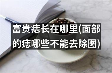 <h3>富贵痣长在哪里(面部的痣哪些不能去除图)