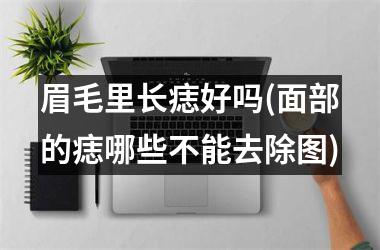 <h3>眉毛里长痣好吗(面部的痣哪些不能去除图)