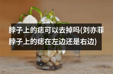 <h3>脖子上的痣可以去掉吗(刘亦菲脖子上的痣在左边还是右边)