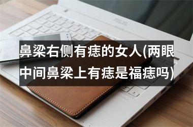 <h3>鼻梁右侧有痣的女人(两眼中间鼻梁上有痣是福痣吗)