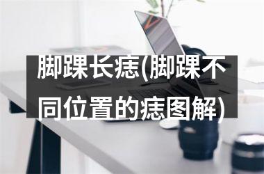 <h3>脚踝长痣(脚踝不同位置的痣图解)