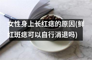 女性身上长红痣的原因(鲜红斑痣可以自行消退吗)