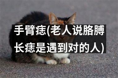 <h3>手臂痣(老人说胳膊长痣是遇到对的人)