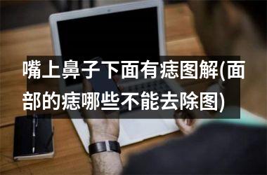 嘴上鼻子下面有痣图解(面部的痣哪些不能去除图)