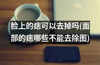 脸上的痣可以去掉吗(面部的痣哪些不能去除图)