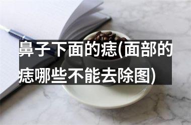 鼻子下面的痣(面部的痣哪些不能去除图)