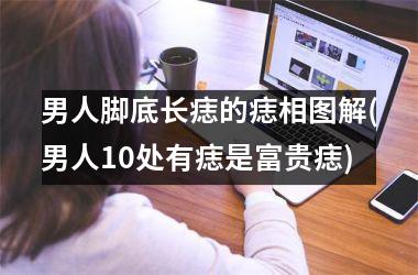 男人脚底长痣的痣相图解(男人10处有痣是富贵痣)