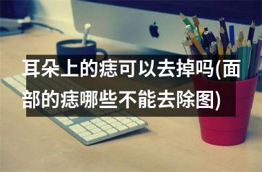 <h3>耳朵上的痣可以去掉吗(面部的痣哪些不能去除图)