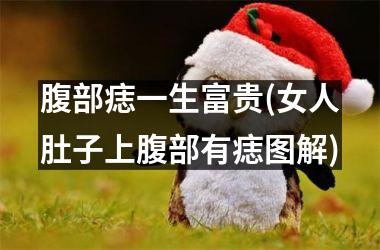 <h3>腹部痣一生富贵(女人肚子上腹部有痣图解)