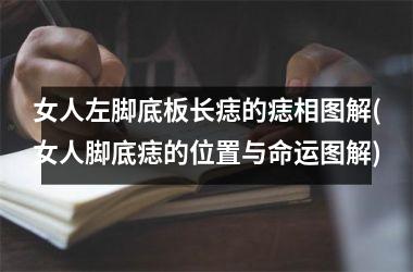 <h3>女人左脚底板长痣的痣相图解(女人脚底痣的位置与命运图解)