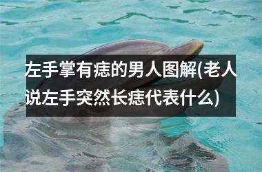 <h3>左手掌有痣的男人图解(老人说左手突然长痣代表什么)