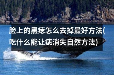 脸上的黑痣怎么去掉最好方法(吃什么能让痣消失自然方法)