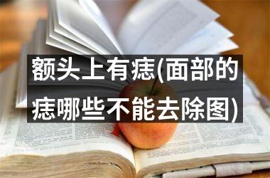 额头上有痣(面部的痣哪些不能去除图)