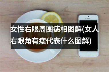 <h3>女性右眼周围痣相图解(女人右眼角有痣代表什么图解)