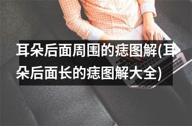 <h3>耳朵后面周围的痣图解(耳朵后面长的痣图解大全)