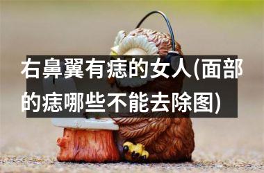 右鼻翼有痣的女人(面部的痣哪些不能去除图)