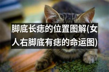 脚底长痣的位置图解(女人右脚底有痣的命运图)