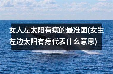 女人左太阳有痣的最准图(女生左边太阳有痣代表什么意思)
