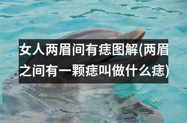 女人两眉间有痣图解(两眉之间有一颗痣叫做什么痣)