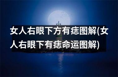 <h3>女人右眼下方有痣图解(女人右眼下有痣命运图解)