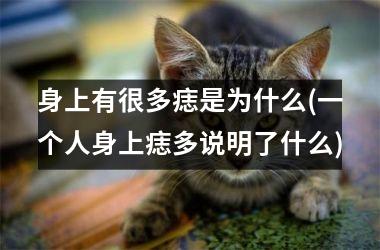 身上有很多痣是为什么(一个人身上痣多说明了什么)