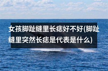 <h3>女孩脚趾缝里长痣好不好(脚趾缝里突然长痣是代表是什么)