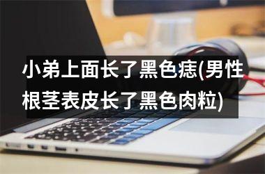 <h3>小弟上面长了黑色痣(男性根茎表皮长了黑色肉粒)