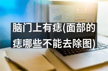 脑门上有痣(面部的痣哪些不能去除图)