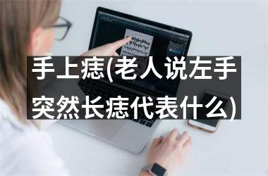 <h3>手上痣(老人说左手突然长痣代表什么)