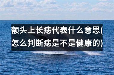 <h3>额头上长痣代表什么意思(怎么判断痣是不是健康的)