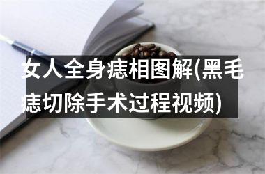 女人全身痣相图解(黑毛痣切除手术过程)