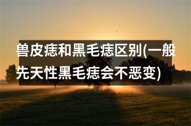 <h3>兽皮痣和黑毛痣区别(一般先天性黑毛痣会不恶变)