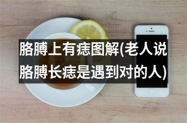 胳膊上有痣图解(老人说胳膊长痣是遇到对的人)